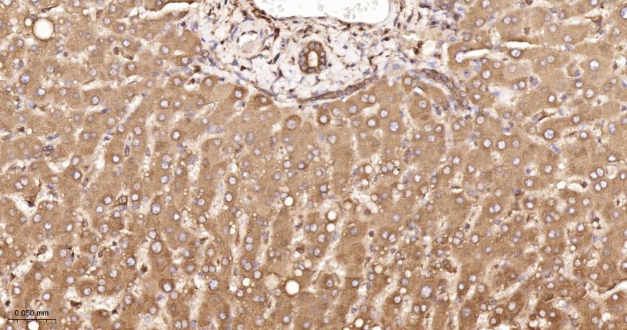 钙连蛋白重组兔单抗