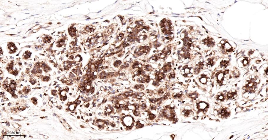 钙连蛋白重组兔单抗