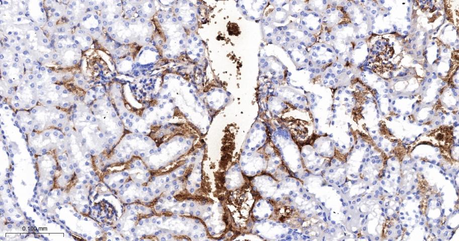 血红蛋白α1/α-Globin重组兔单抗-bsm-60287R