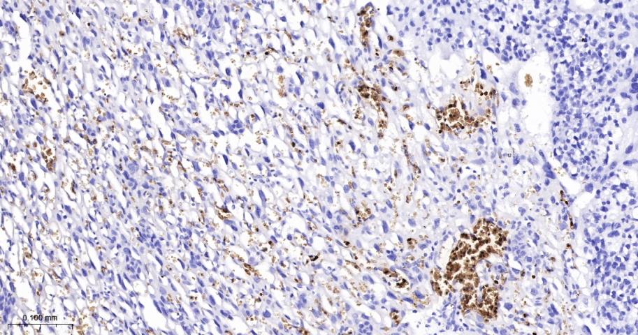 血红蛋白α1/α-Globin重组兔单抗-bsm-60287R