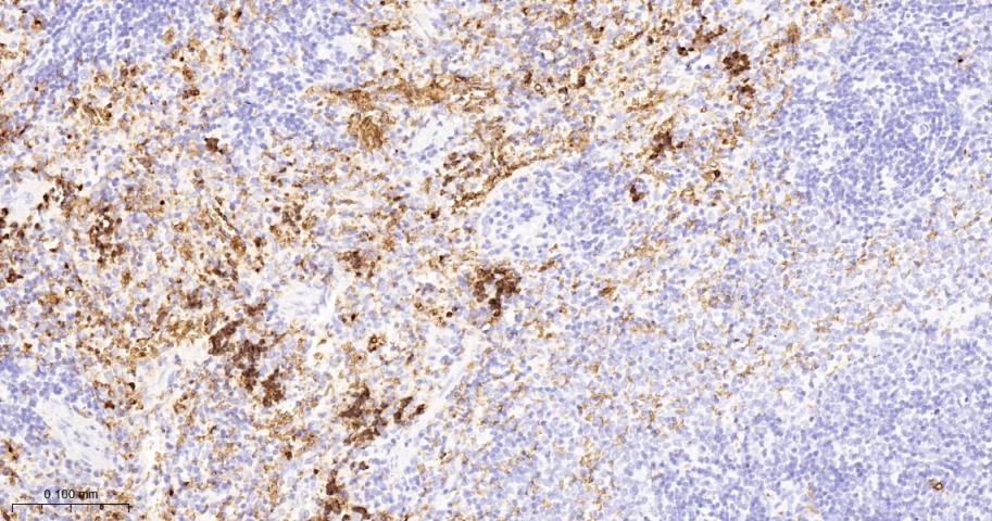 血红蛋白α1/α-Globin重组兔单抗-bsm-60287R