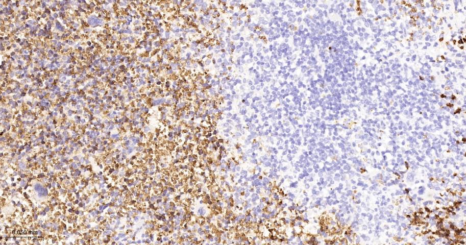 血红蛋白α1/α-Globin重组兔单抗-bsm-60287R