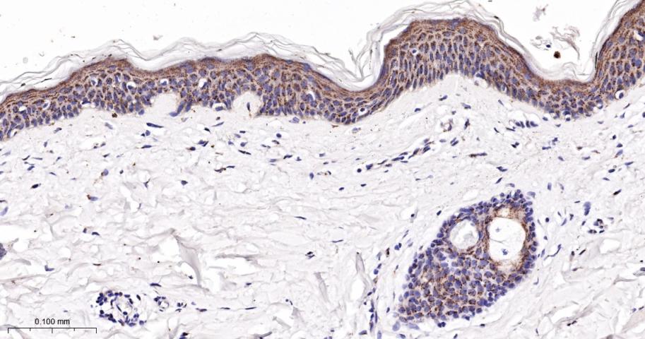 成纤维细胞生长因子受体3重组兔单抗-bsm-60715R