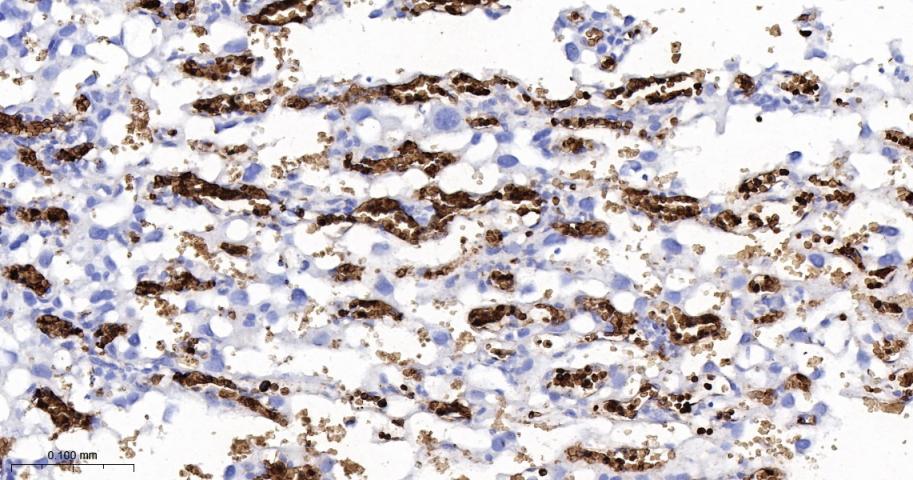 血红蛋白α1/α-Globin重组兔单抗-bsm-60287R