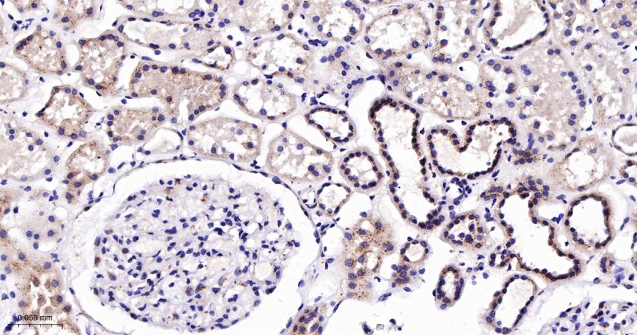 成纤维细胞生长因子受体3重组兔单抗-bsm-60715R