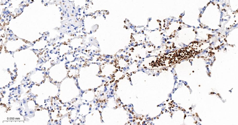 HBA1 Recombinant Rabbit mAb (一抗) - WB,IHC-P,IHC-F,IF,Flow-Cyt,IP | Bioss
