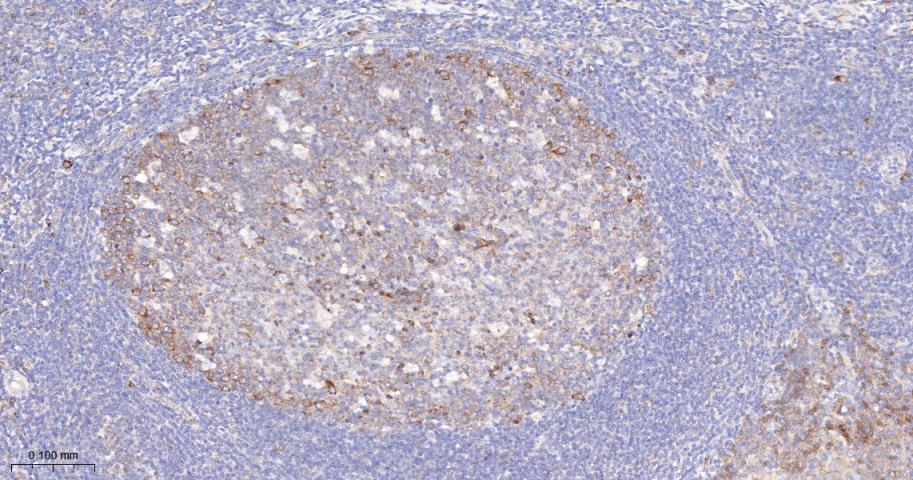 磷酸化叉头蛋白3A重组兔单抗