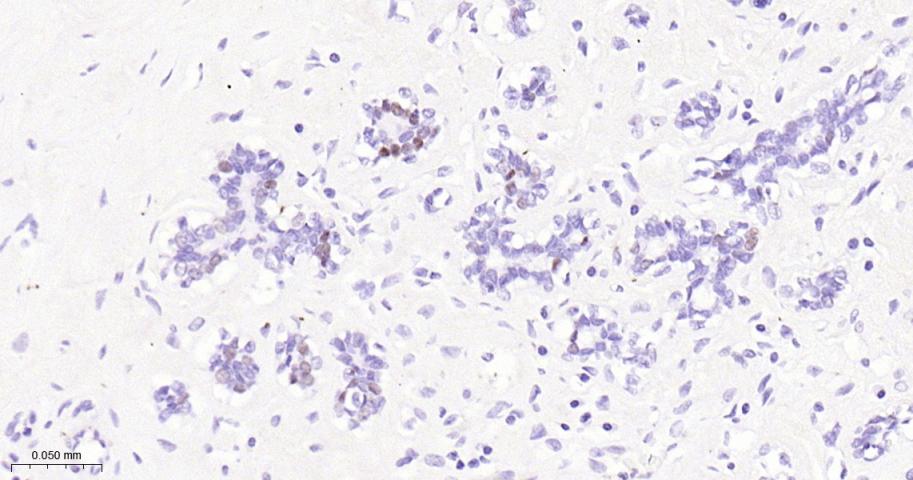 雌激素受体α重组兔单克隆抗体