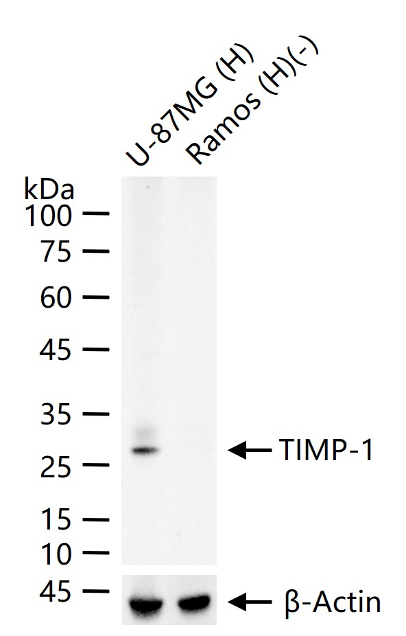 金属蛋白酶组织抑制因子-1重组兔单抗