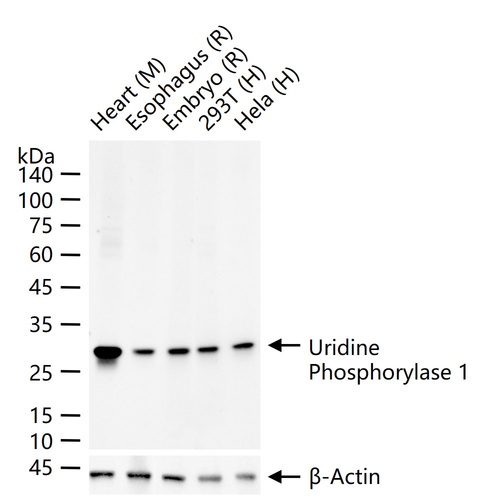 尿嘧啶核苷磷酸化酶1重组兔单抗