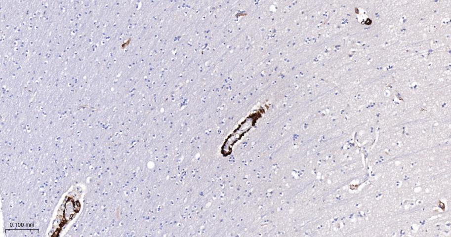 细胞骨架相关蛋白重组兔单抗