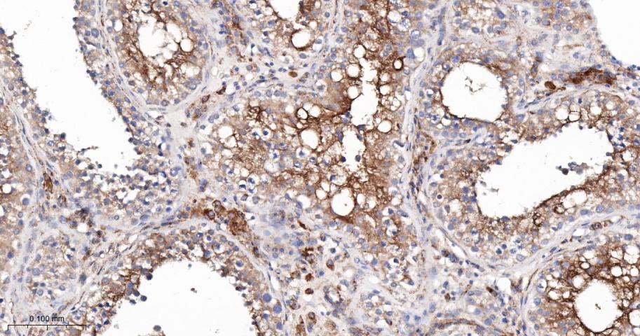 干扰素诱导跨膜蛋白3重组兔单抗