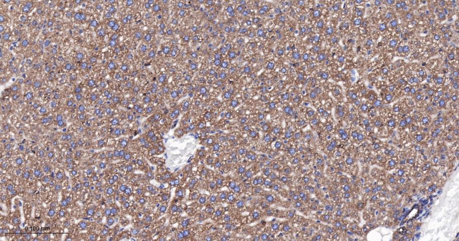 肌浆/内质网钙ATP酶2重组兔单抗-bsm-61408R