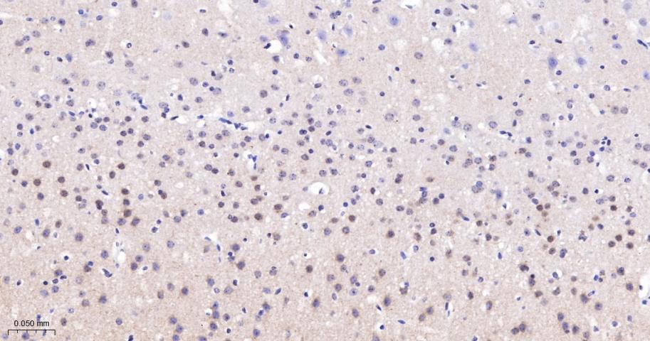 磷酸化蛋白激酶C α/β2重组兔单抗
