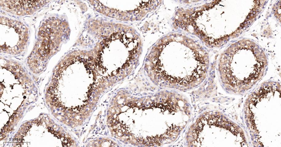 蛋白激酶C-δ/θ重组兔单抗