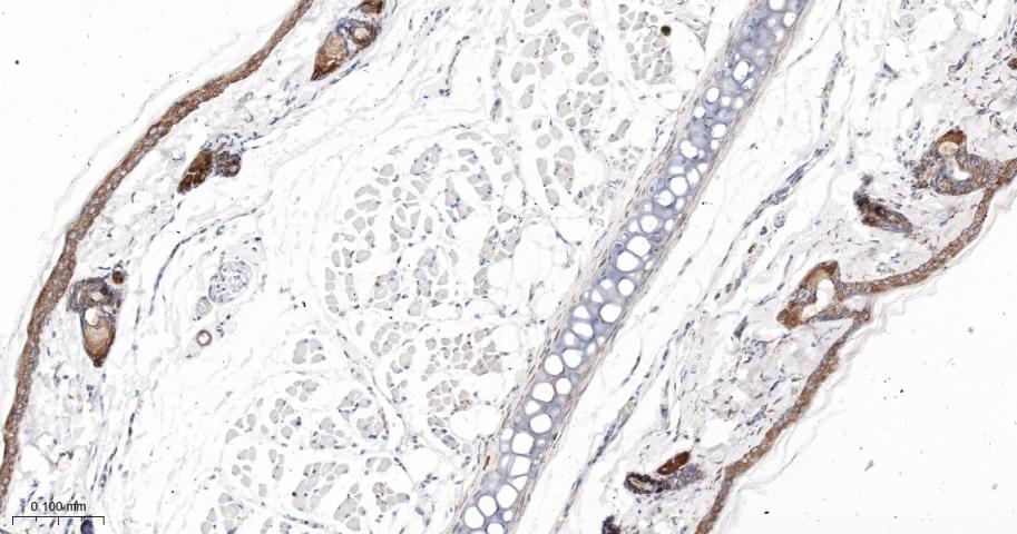 肌浆/内质网钙ATP酶2重组兔单抗-bsm-61408R