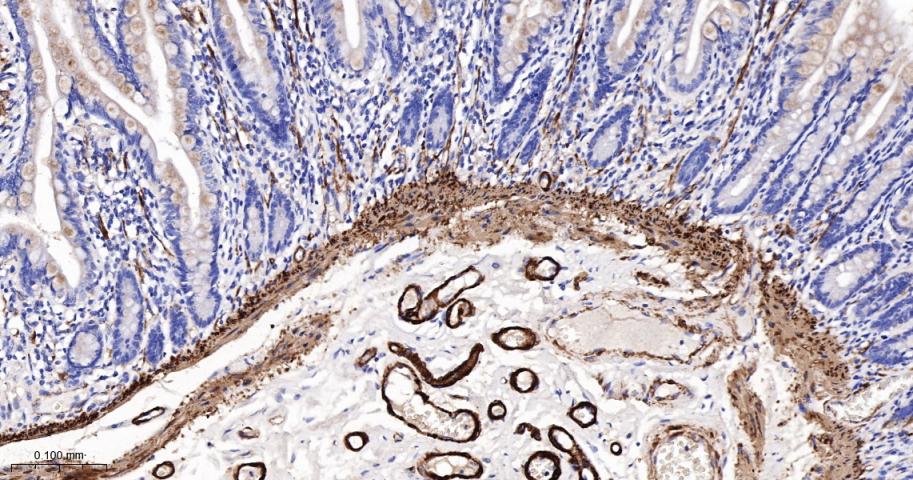 细胞骨架相关蛋白重组兔单抗