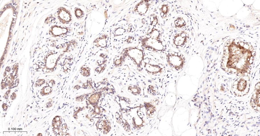 蛋白激酶C-δ/θ重组兔单抗