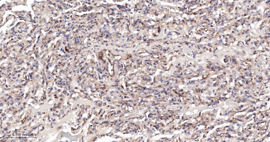 干扰素诱导跨膜蛋白3重组兔单抗
