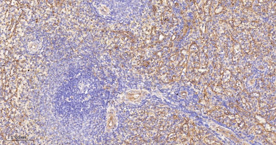 干扰素诱导跨膜蛋白3重组兔单抗