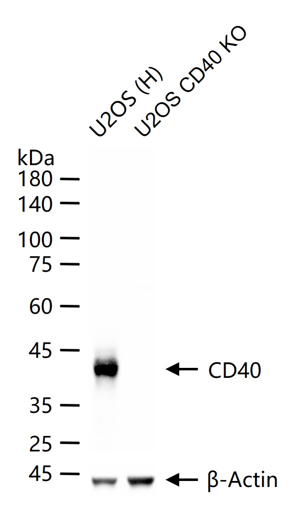 CD40 重组兔单克隆抗体