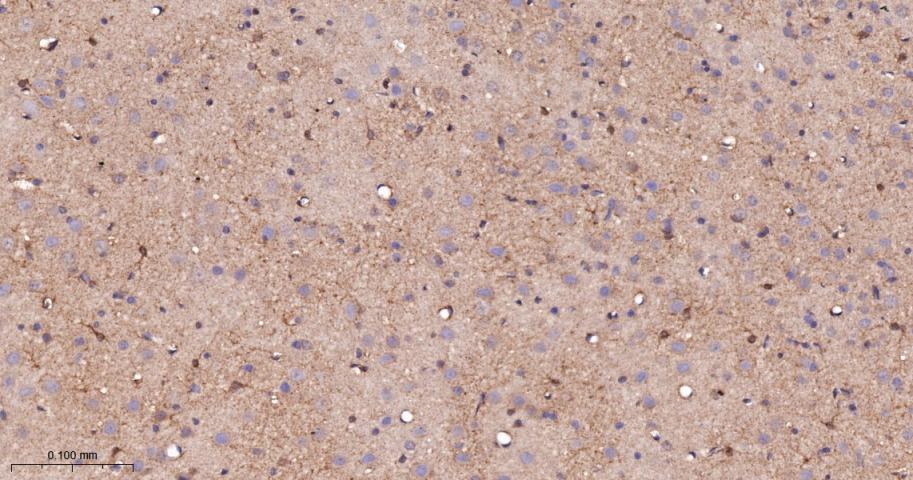 蛋白激酶C-δ/θ重组兔单抗