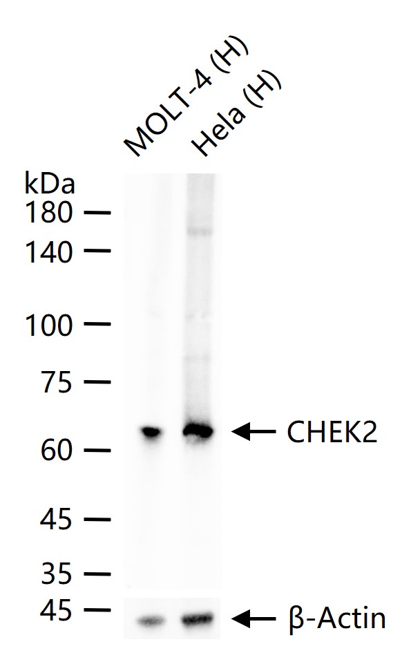 CHEK2 Mouse mAb (一抗) - WB | Bioss