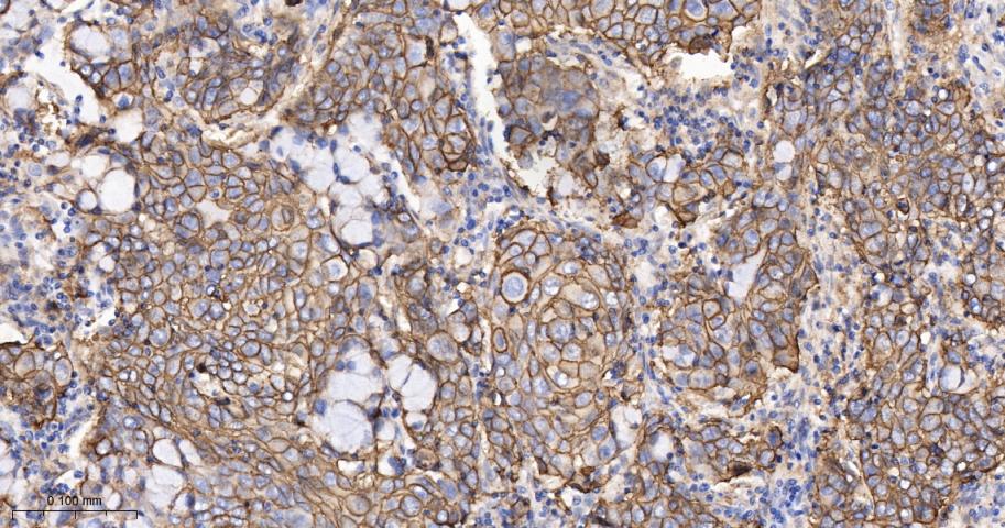 S100钙结合蛋白A10重组兔单抗