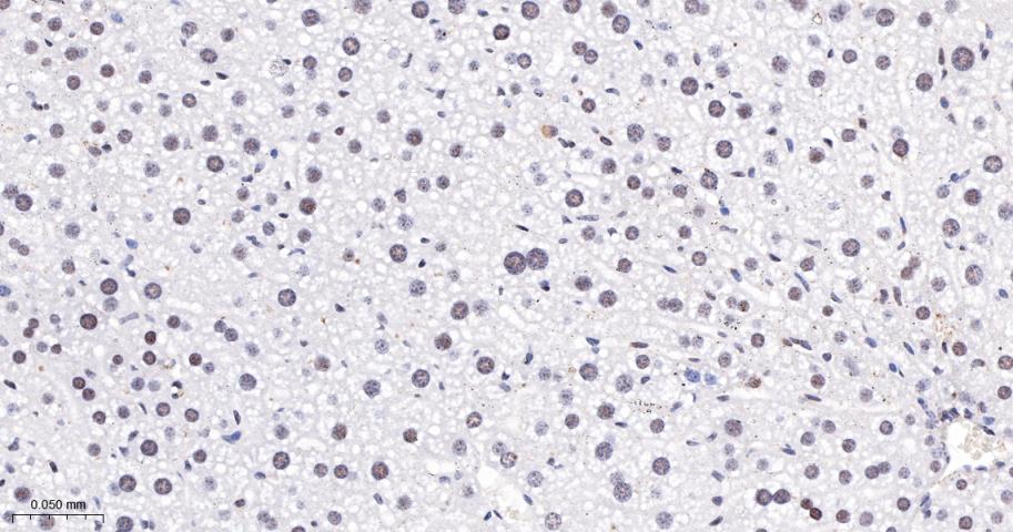 磷酸化蛋白激酶C α/β2重组兔单抗