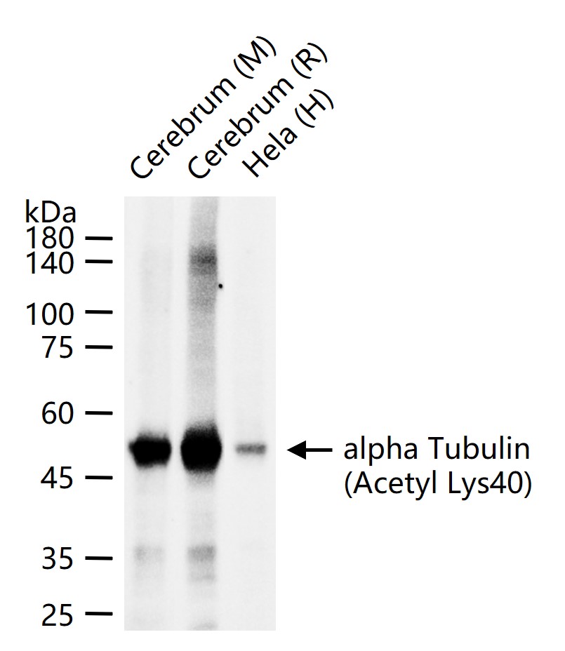 alpha Tubulin (Acetyl Lys40) Mouse mAb (一抗) - WB | Bioss