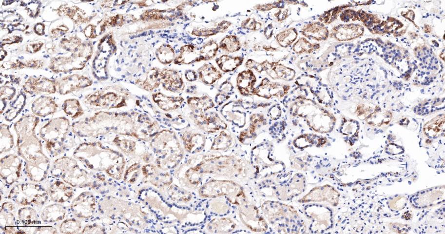 磷酸化丙酮酸脱氢酶α1重组兔单抗
