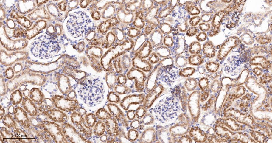 肌浆/内质网钙ATP酶2重组兔单抗-bsm-61408R