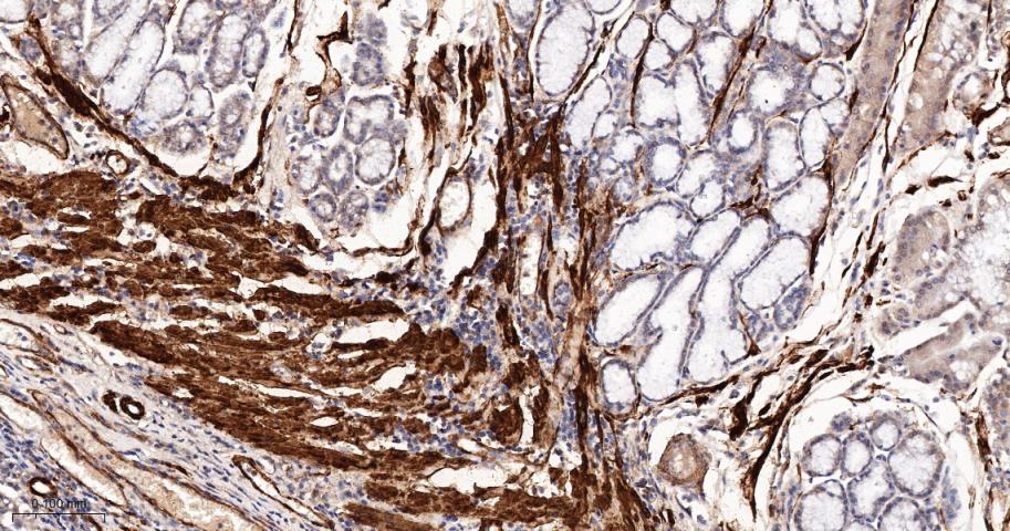 细胞骨架相关蛋白重组兔单抗