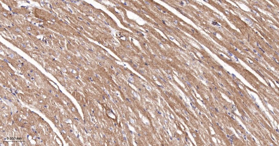 肌浆/内质网钙ATP酶2重组兔单抗-bsm-61408R