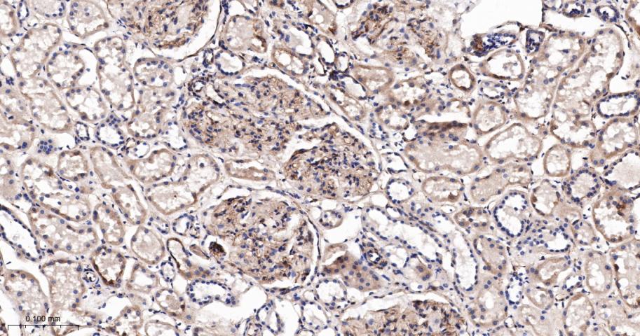干扰素诱导跨膜蛋白3重组兔单抗