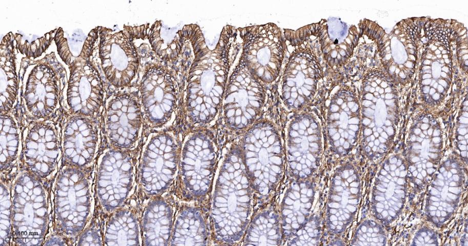 S100钙结合蛋白A10重组兔单抗