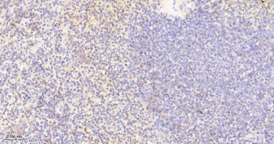 磷酸化蛋白激酶C α/β2重组兔单抗