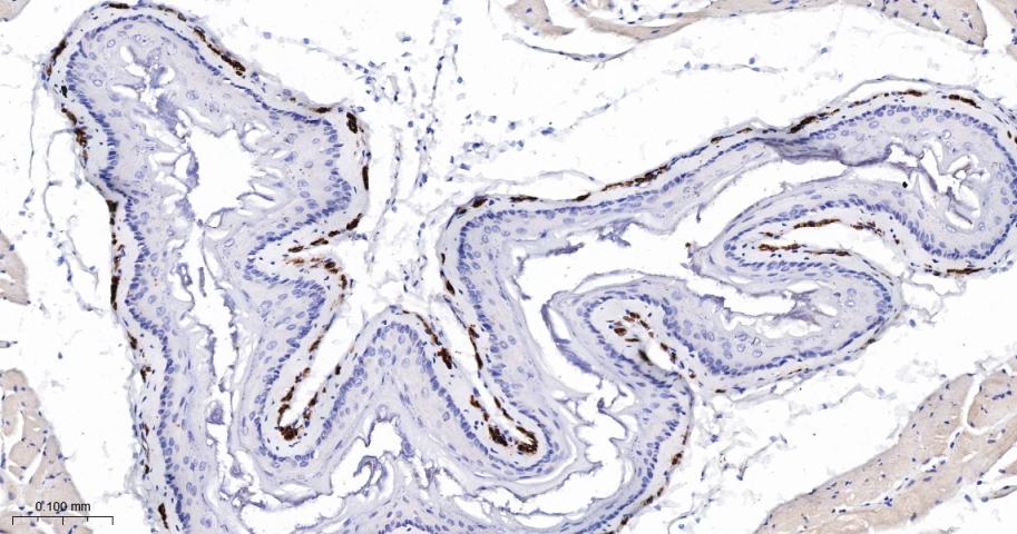 细胞骨架相关蛋白重组兔单抗