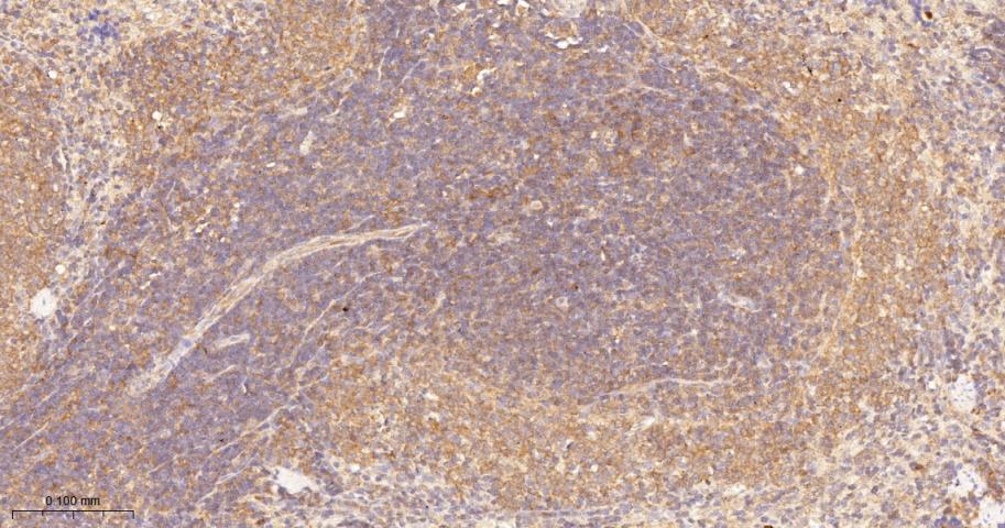 蛋白激酶C-δ/θ重组兔单抗