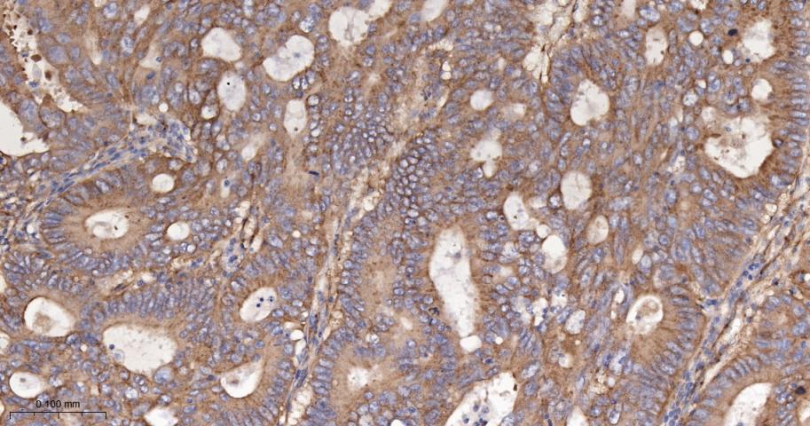 干扰素诱导跨膜蛋白3重组兔单抗