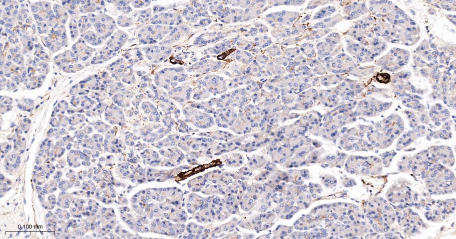 细胞骨架相关蛋白重组兔单抗
