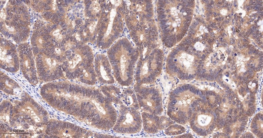 亲环蛋白（亲环素）PPIA重组兔单抗