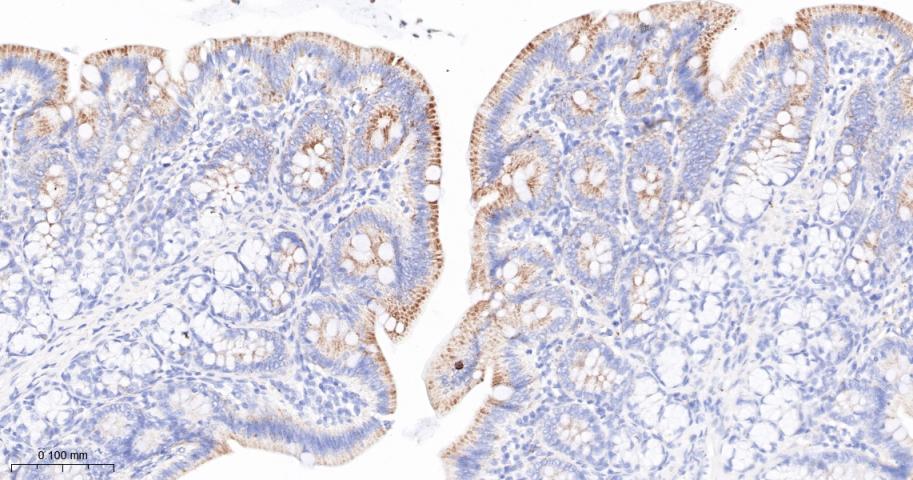 磷酸化丙酮酸脱氢酶α1重组兔单抗