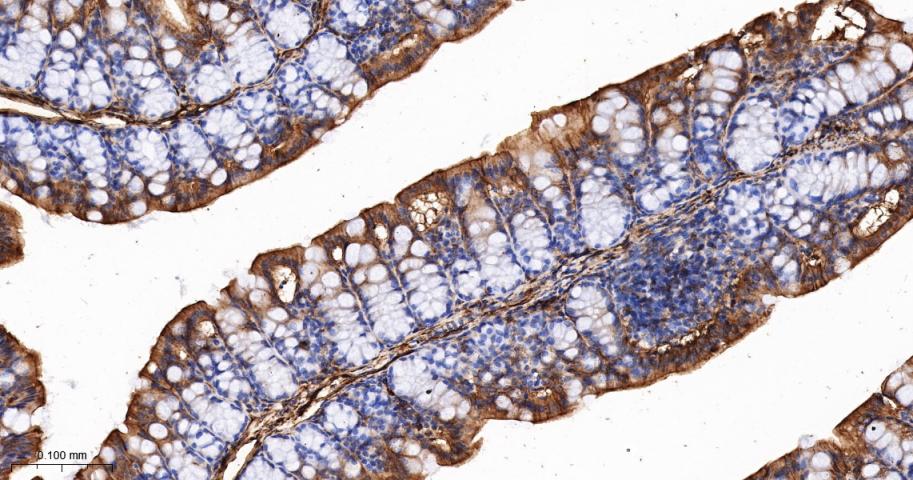 S100钙结合蛋白A10重组兔单抗