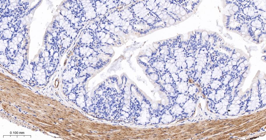 细胞骨架相关蛋白重组兔单抗