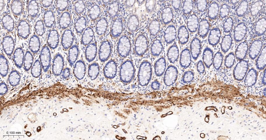 细胞骨架相关蛋白重组兔单抗