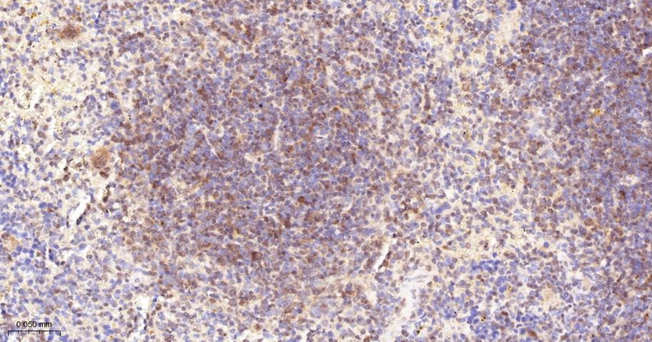 磷酸化蛋白激酶C α/β2重组兔单抗