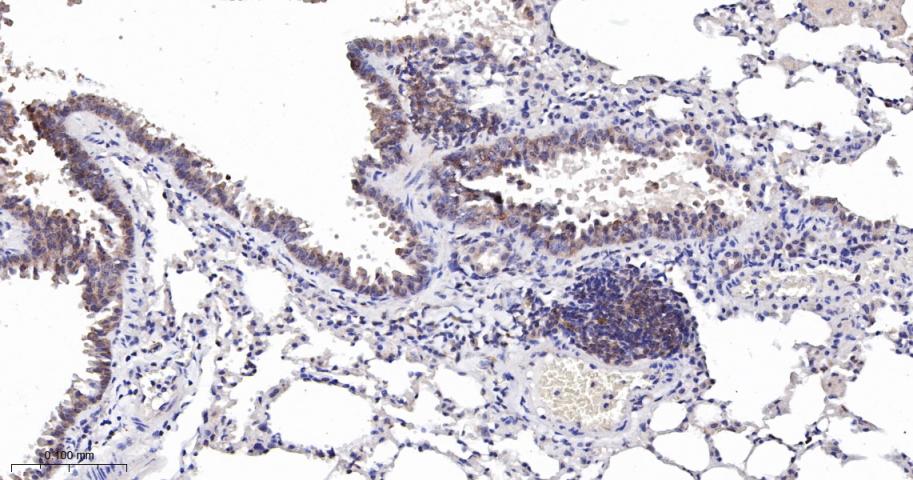 亲环蛋白（亲环素）PPIA重组兔单抗