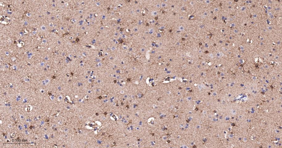 磷酸化蛋白激酶C α/β2重组兔单抗