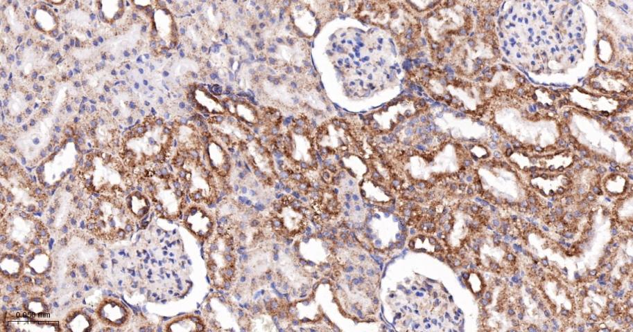 肌浆/内质网钙ATP酶2重组兔单抗-bsm-61408R